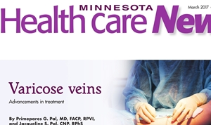Do I Need Varicose Vein Treatment?