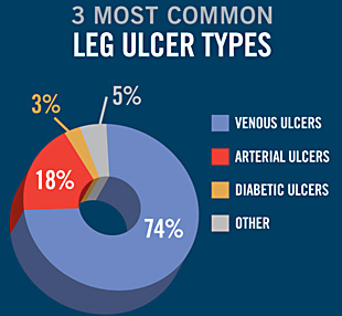 Venous Ulcers
