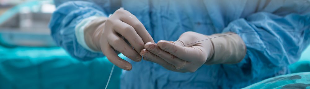 What is Ambulatory Microphlebectomy
